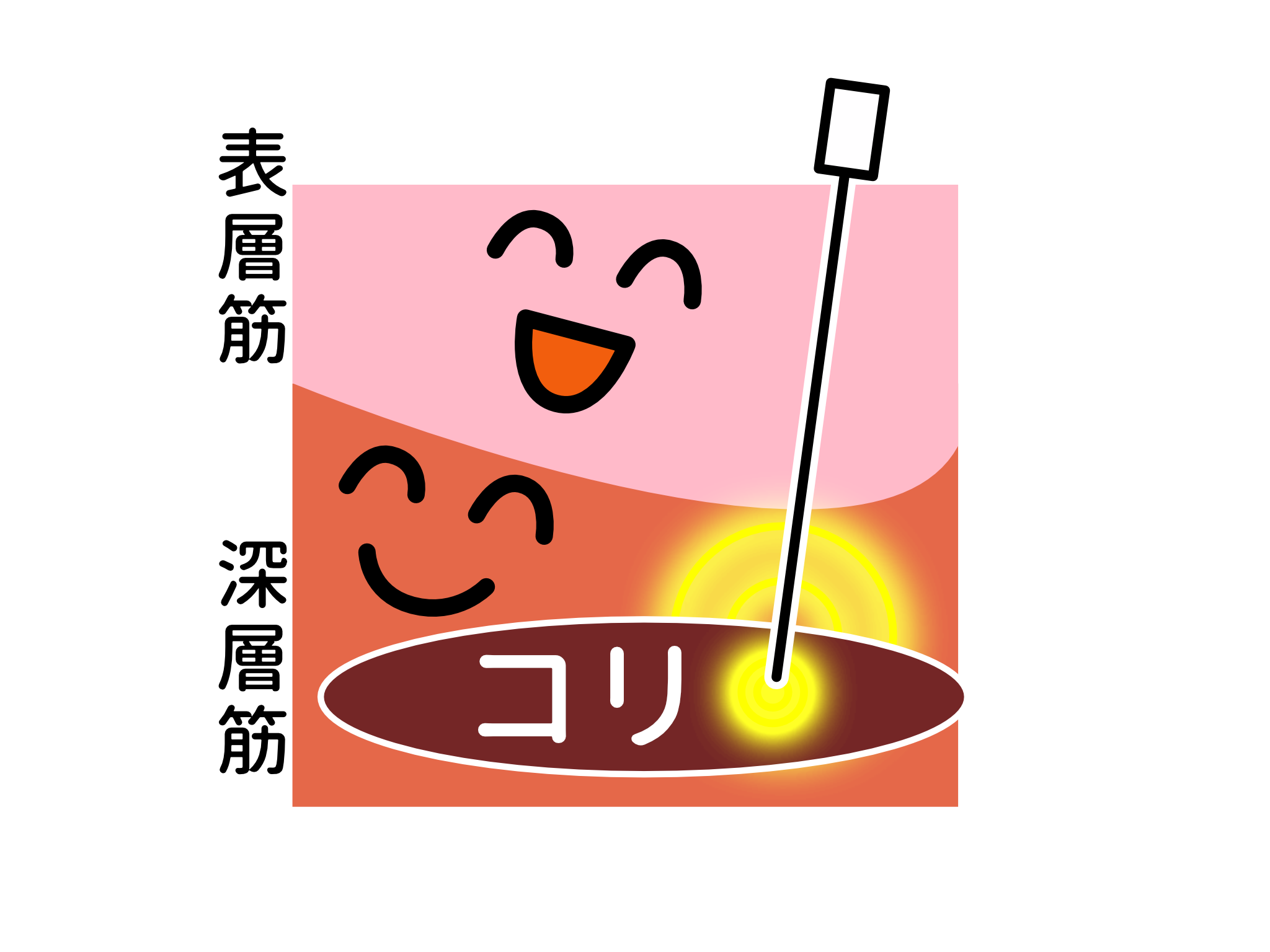 ☀️🌿夏の自律神経ケアは「鍼」でスッキリ整えましょう🌿☀️